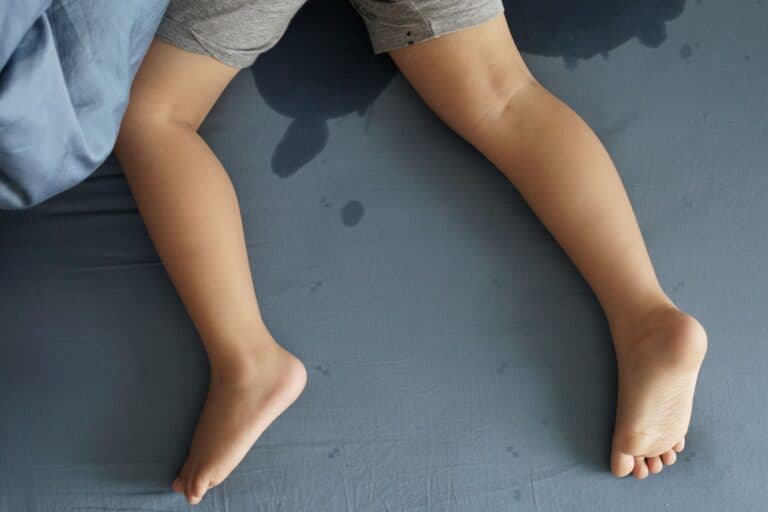 Kinderbeine und -füsse in nassem Bett. Bettnässen? Wie unser achtjähriges Kind nachts mit Hilfe eines Weckapparats trocken wurde.