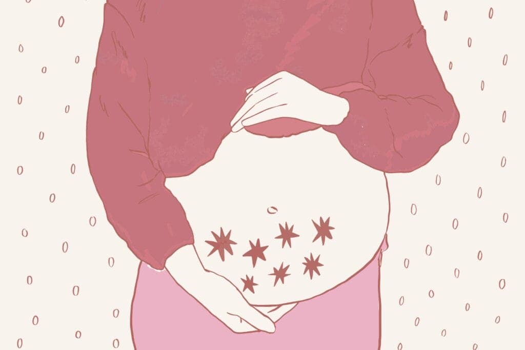Illustration eines schwangeren Bauches, darauf sind sieben Sterne abgebildet. - Selektive Abtreibung eines Zwillings, ein Erfahrungsbericht.